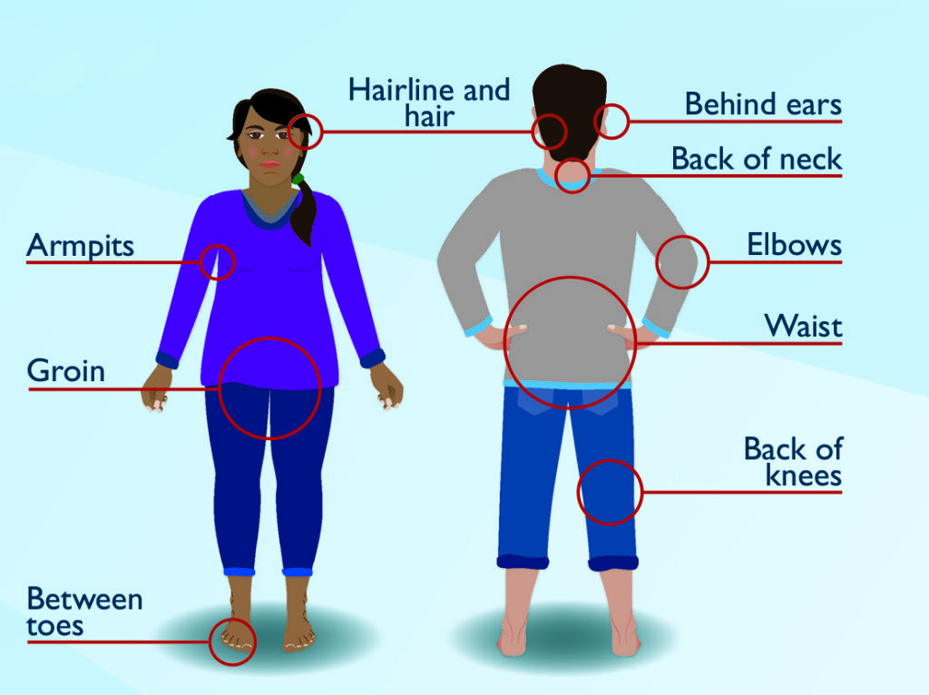 Key area to check for ticks image