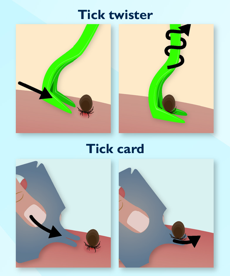 Tick removal tool image